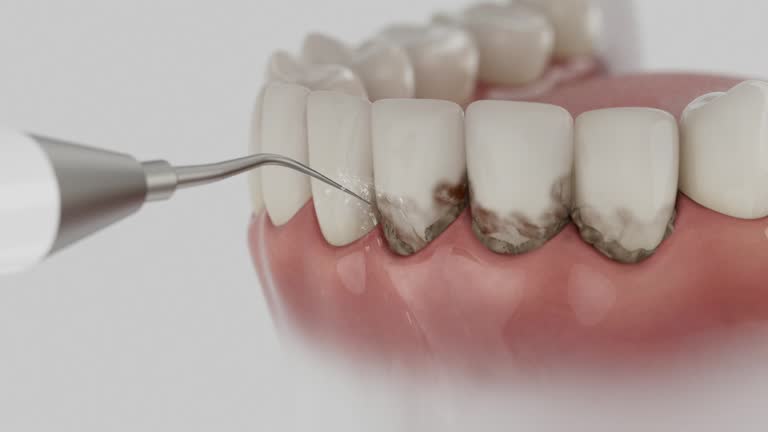Trusted Emergency Dentist service in Fairfield, IA - Dentist Open Now
